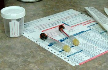 Test delle urine